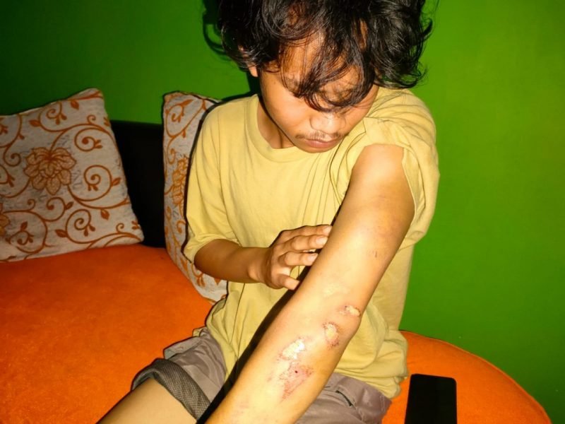 RN yang masih terluka