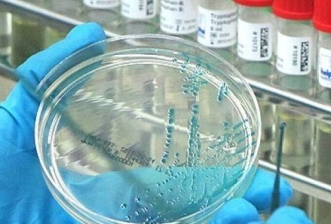 Virus-flu-burung-penyakit-unggas